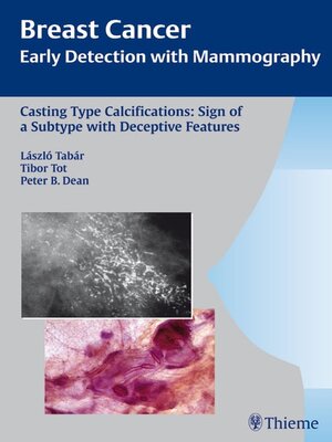 cover image of Breast Cancer